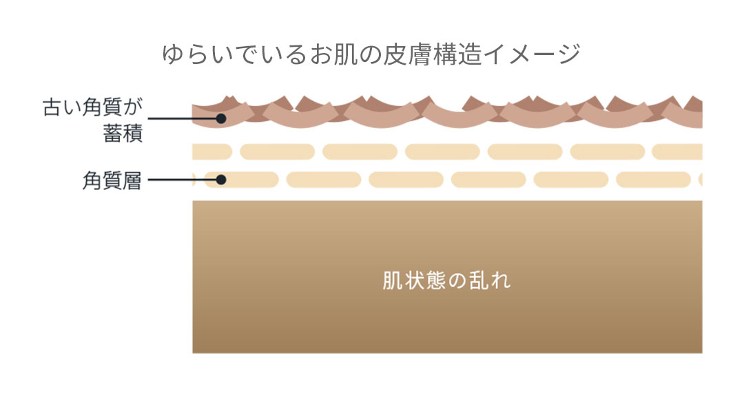 ゆらぎ肌とは?