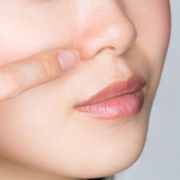 ゆらぎ肌とは？